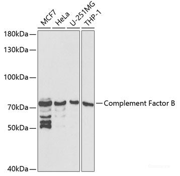 Western blot analysis of extracts of Mouse liver using MOK Polyclonal Antibody at dilution of 1:1000.