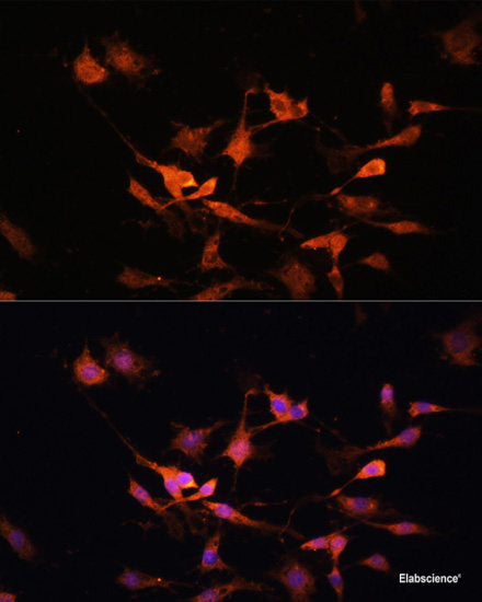Western blot analysis of extracts of various cell lines using RGS4 Polyclonal Antibody at dilution of 1:1000.