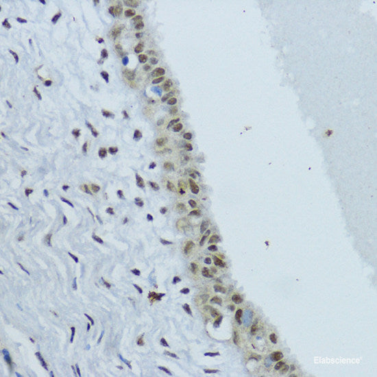 Western blot analysis of extracts of various cell lines using VEGF Monoclonal Antibody at dilution of 1:500.