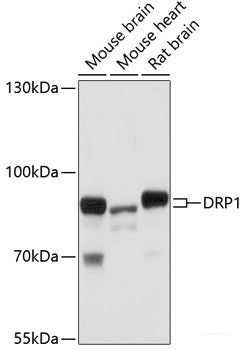 Western blot analysis of extracts of various cell lines using Acetyl-Histone H3-K9/K14/K18/K23/K27 Polyclonal Antibody at dilution of 1:1000. HeLa cells were treated by TSA (1 uM) at 37°C for 18 hours. NIH/3T3 cells were treated by TSA (1 uM) at 37°C for 18 hours. C6 cells were treated by TSA (1 uM) at 37°C for 18 hours.
