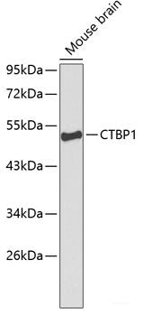 Immunohistochemistry of paraffin-embedded Rat kidney using PDE3A Polyclonal Antibody at dilution of 1:100 (40x lens).
