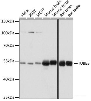 Western blot analysis of extracts of various cell lines using MS4A1 Polyclonal Antibody at dilution of 1:1000.