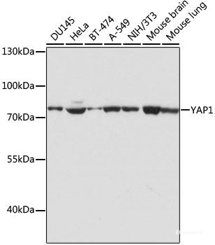 Immunohistochemistry of paraffin-embedded Rat kidney using DCK Polyclonal Antibody at dilution of 1:100 (40x lens).