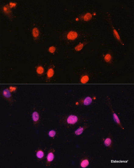 Western blot analysis of extracts of various cell line using SENP2 Polyclonal Antibody at dilution of 1:1000.