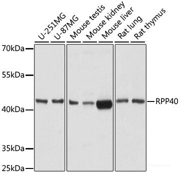 Immunohistochemistry of paraffin-embedded Rat pancreas using CYP24A1 Polyclonal Antibody at dilution of 1:200 (40x lens).