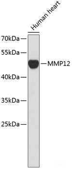 Western blot analysis of extracts from normal (control) and UBE2S knockout (KO) 293T cells using UBE2S Polyclonal Antibody at dilution of 1:1000.