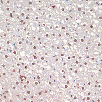 Immunofluorescence analysis of Rat thymus using ICOS Polyclonal Antibody at dilution of 1:100. Blue: DAPI for nuclear staining.