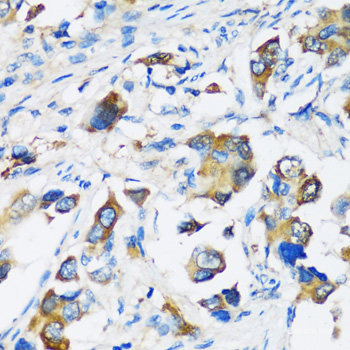 Immunofluorescence analysis of U2OS cells using FANCC Polyclonal Antibody