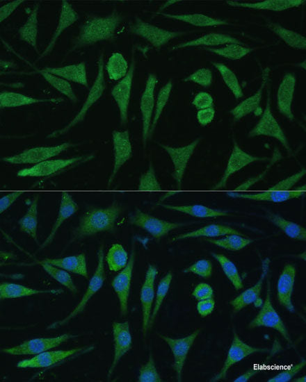 Immunofluorescence analysis of C6 cells using Pan-AKT Polyclonal Antibody at dilution of 1:100. Blue: DAPI for nuclear staining.