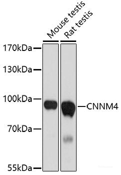 Western blot analysis of extracts of MCF7 cells using CEACAM5 Monoclonal Antibody at dilution of 1:1000.