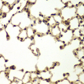 Immunofluorescence analysis of C6 cells using ASPM Polyclonal Antibody at dilution of 1:100. Blue: DAPI for nuclear staining.