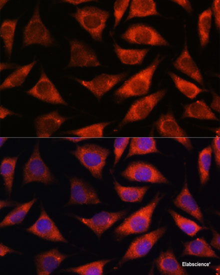Western blot analysis of extracts of various cell lines using CYSLTR1 Polyclonal Antibody at dilution of 1:1000.
