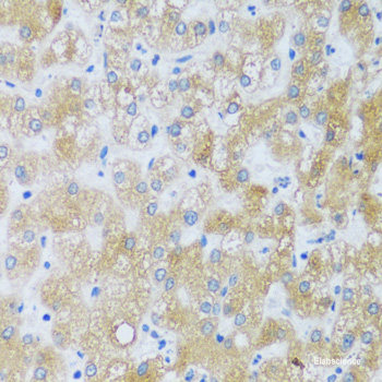Western blot analysis of extracts of HeLa cells using EIF2AK3 Polyclonal Antibody at dilution of 1:1000.