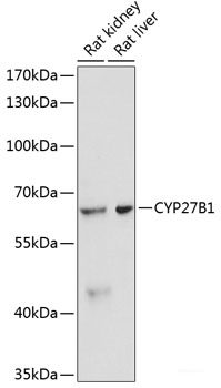 Immunohistochemistry of paraffin-embedded Rat kidney using KEAP1 Polyclonal Antibody at dilution of 1:100 (40x lens).