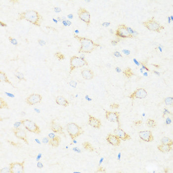 Western blot analysis of extracts of SW620 cells using POLR2F Polyclonal Antibody at dilution of 1:1000.