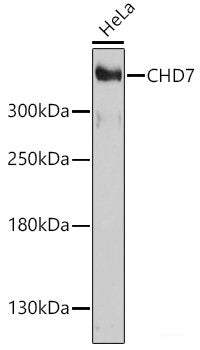 Western blot analysis of extracts of various cell lines using THPO Polyclonal Antibody at dilution of 1:1000.