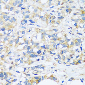 Western blot analysis of extracts of various cell lines using PPARA Polyclonal Antibody at dilution of 1:1000.