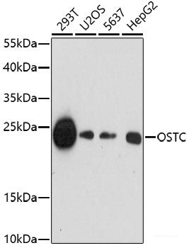 Immunohistochemistry of paraffin-embedded Rat brain using CARTPT Polyclonal Antibody at dilution of 1:100 (40x lens).