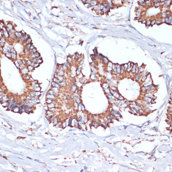 Immunohistochemistry of paraffin-embedded Rat testis using NOTCH1 Polyclonal Antibody at dilution of 1:100 (20x lens).