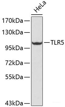 Western blot analysis of extracts of various cell lines using pan-TriMethyl-lysine Polyclonal Antibody at dilution of 1:500. HeLa and MCF7 cells were treated by ADOX (100 μM) for 24 hours.