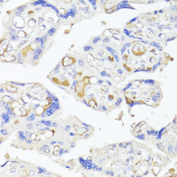 Immunohistochemistry of paraffin-embedded Rat brain using IL10RA Polyclonal Antibody at dilution of 1:200 (40x lens).