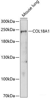 Western blot analysis of extracts of various cell lines using GPR22 Polyclonal Antibody at dilution of 1:1000.