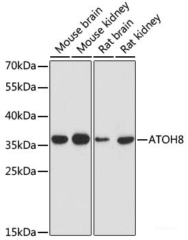 Western blot analysis of extracts of various cell lines using PCIF1 Polyclonal Antibody at dilution of 1:1000.