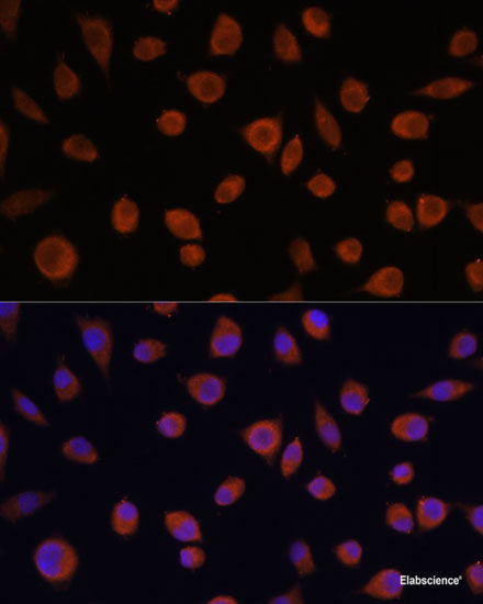 Western blot analysis of extracts of various cell lines using SFTPC Polyclonal Antibody at dilution of 1:1000.