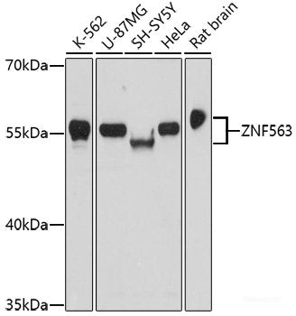 Western blot analysis of extracts of various cell lines using RPGR Polyclonal Antibody at dilution of 1:1000.