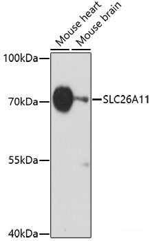 Western blot analysis of extracts of various cell lines using ARG1 / Arginase 1 Polyclonal Antibody at dilution of 1:2000.