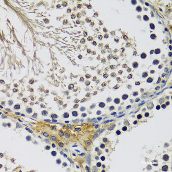 Immunofluorescence analysis of U2OS cells using IKZF1 Polyclonal Antibody