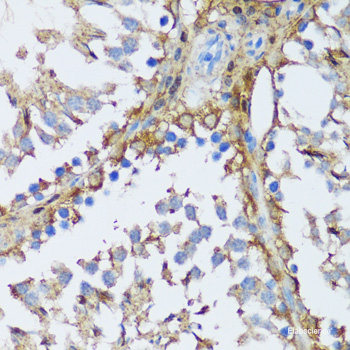 Immunohistochemistry of paraffin-embedded Human colon using RNASE3 Polyclonal Antibody at dilution of 1:100 (40x lens).