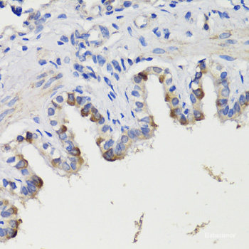 Western blot analysis of extracts of various cell lines using HSPA1L Polyclonal Antibody at dilution of 1:500.