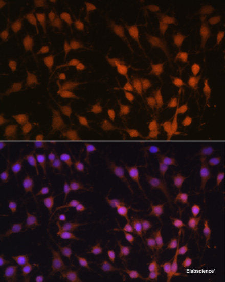 Western blot analysis of extracts of various cell lines using IDS Polyclonal Antibody at dilution of 1:1000.