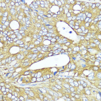 Immunofluorescence analysis of MCF-7 cells using LIG1 Polyclonal Antibody
