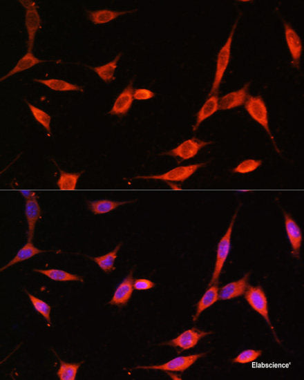 Western blot analysis of extracts of SKOV3 cells using ZMPSTE24 Polyclonal Antibody at dilution of 1:1000.