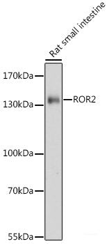 Western blot analysis of extracts of various cell lines using Amphiregulin Polyclonal Antibody at dilution of 1:1000.
