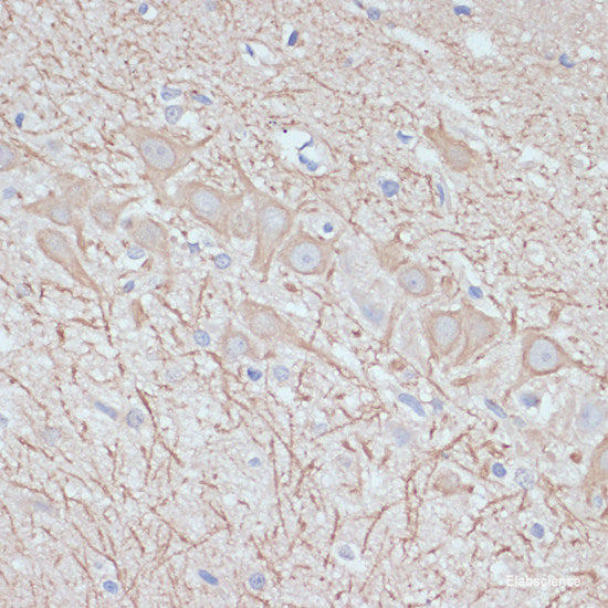 Immunofluorescence analysis of A431 cells using LAMC2 Polyclonal Antibody at dilution of 1:100 (40x lens). Blue: DAPI for nuclear staining.