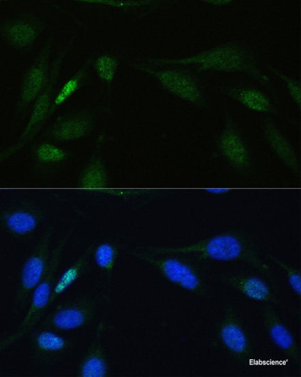 Immunofluorescence analysis of A-549 cells using ATG16L1 Polyclonal Antibody