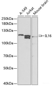 Immunohistochemistry of paraffin-embedded Rat kidney using LIPG Polyclonal Antibody at dilution of 1:200 (40x lens).