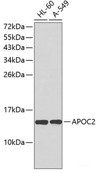 Immunohistochemistry of paraffin-embedded Human stomach using IL11 Polyclonal Antibody at dilution of 1:100 (40x lens).