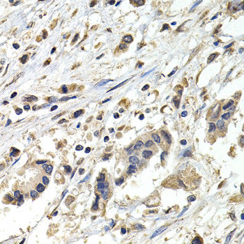 Immunohistochemistry of paraffin-embedded Rat kidney using FHL2 Polyclonal Antibody at dilution of 1:100 (40x lens).