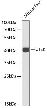 Immunohistochemistry of paraffin-embedded Rat kidney using DLC1 Polyclonal Antibody at dilution of 1:200 (40x lens).