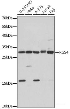 Western blot analysis of extracts of various cell lines using TNNC1 Polyclonal Antibody at dilution of 1:1000.