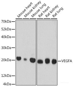 Western blot analysis of extracts of various cell lines using BUB1 Polyclonal Antibody at dilution of 1:1000.