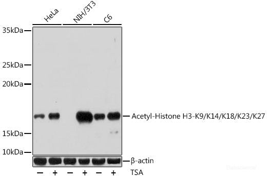 Immunohistochemistry of paraffin-embedded Human esophageal cancer using GPX4 Polyclonal Antibody at dilution of 1:200 (40x lens).