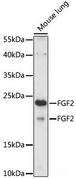 Western blot analysis of extracts of various cell lines using GRIK2 Polyclonal Antibody at dilution of 1:1000.