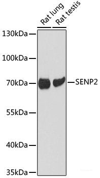 Immunohistochemistry of paraffin-embedded Rat lung using S100A7 Polyclonal Antibody at dilution of 1:100 (40x lens).
