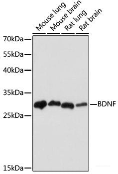 Immunohistochemistry of paraffin-embedded Human colon carcinoma using CDC27 Polyclonal Antibody at dilution of 1:200 (40x lens).
