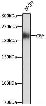 Immunohistochemistry of paraffin-embedded Human lung cancer using MCM6 Polyclonal Antibody at dilution of 1:100 (40x lens).